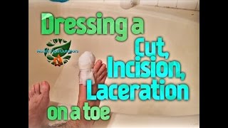 Dressing a cut incision laceration on a toe  MuddyTigerOutdoors [upl. by Sykleb]