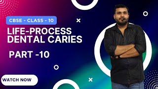 Life Processes Class 10 Science Biology  Lecture10  CBSE Board  Devendra Sir [upl. by Koressa41]