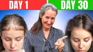 Barbara ONeills SHOCKING Hair Loss Discovery What They Hid From You [upl. by Timofei889]