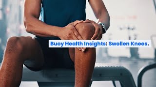 Swollen Knees Common Causes and Where to Seek Medical Care  BuoyHealthcom [upl. by Spatola]