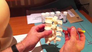 Lumbar Puncture Series  4 Lumbar Spine Anatomy and Needle Trajectory [upl. by Eecal646]