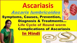 Ascariasis  Ascaris Lumbricoides  Symptoms Causes Diagnosis Treatment  Roundworm life cycle [upl. by Voleta854]