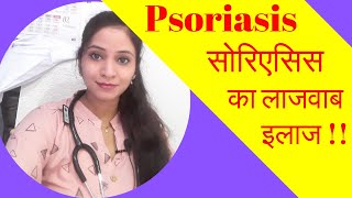 Psoriasis treatment homeopathy  psoriasis homoeopathic medicines  psoriasis scalp treatment [upl. by Ataner]