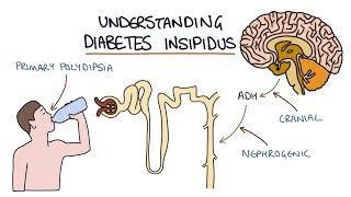 Understanding Diabetes Insipidus [upl. by Debra]