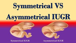 Symmetrical and Asymmetrical IUGR Differences  Symmetrical Vs Asymmetrical IUGR [upl. by Idalia159]