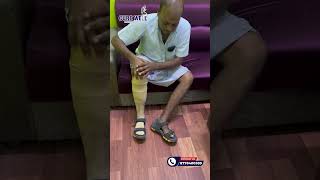 BELOW KNEE PROSTHESIS WITH ASPIRE LINER OSSUR AND BREEZE FOOT OSSUR [upl. by Anawed]