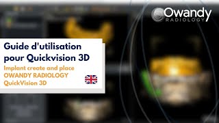 4 Implant create and placeOWANDY RADIOLOGYQuickVision 3D [upl. by Ardnassela]