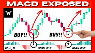 Ultimate MACD Indicator Trading Course EXPERT INSTANTLY [upl. by Els]