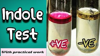 Indole test  Microbiology Microbial Biochemical test [upl. by Hymie57]