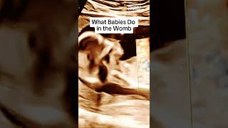 🤯🤯CRAZY Things Babies Do In The Womb [upl. by Aholla]