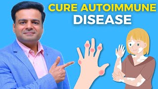 1 Best Way To Cure Autoimmune Diseases [upl. by Flanigan804]