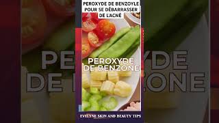 Le peroxyde de benzoyle pour éliminer lacné et les boutons [upl. by Latif]