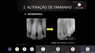 Anomalias dentárias [upl. by Eelram291]