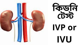 IVP or IVU kidney test কিডনি টেস্ট IVP or IVU [upl. by Ahsemat]