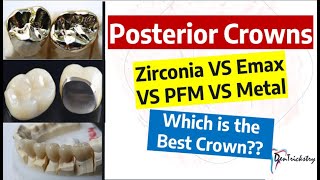 DENTAL CROWN TYPES Zirconia Emax PFZ PFM Metal Choosing the BEST [upl. by Annoeik]