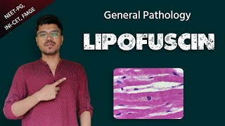 Lipofuscin  Pathology  NEETPG  INICET  FMGE [upl. by Gottlieb]