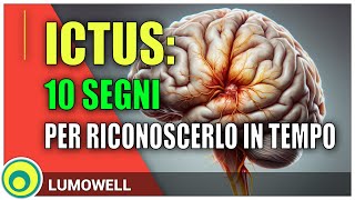 I Sintomi di un Ictus Cerebrale [upl. by Vyner46]