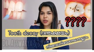 Tooth decayദന്തക്ഷയം and treatments DrAiswaryaSreekumar [upl. by Cooe]