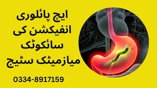 Homeopathic Treatment for H Pylori and Stomach Ulcer  Hyperacidity Sycotic Miasm hpylori ibs [upl. by Jagir]