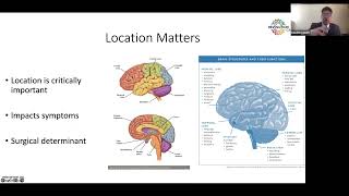 The Glioblastoma Brain Cancer Patient Journey DEMYSTIFIED [upl. by Jehiel]