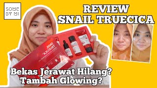 REVIEW SOME BY MI SNAIL TRUECICA STARTER KIT  MENGHILANGKAN BEKAS JERAWAT [upl. by Elidad415]