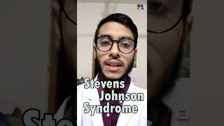 Stevens Johnson Syndrome  Sulfonamide  Penicillin  Antibiotics  Adverse effects [upl. by Llerot]