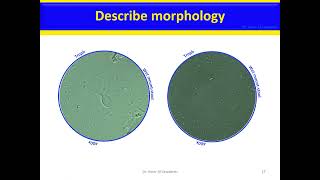 Giardia lamblia Giardia intestinalis Giardia doudenalis version 2 [upl. by Kcid]