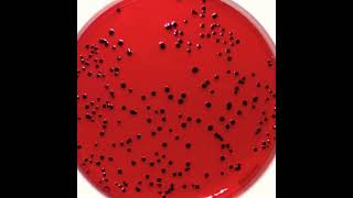 Isolation Salmonella bacteria on XLD agar  Microbiology [upl. by Yzdnil]