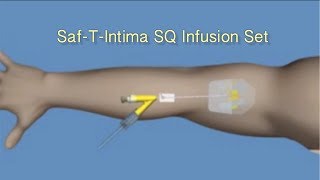 How to Insert SafTIntima™ SQ Infusion Set [upl. by Brighton]