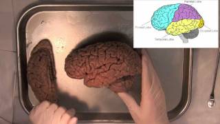 MIT Introduction to Neuroanatomy Series Part 1 [upl. by Attennot]