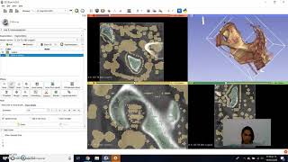 Conversion de archivo DICOM a STL en 3D Slicer [upl. by Howlond16]