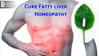 Simple Lifestyle Tips to deal FATTY LIVER  Causes amp Symptoms  Dr Surekha Tiwari  Doctors Circle [upl. by Eelanna]