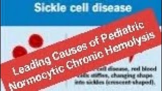 Leading Causes of Pediatric Normocytic Chronic Hemolysis SCD [upl. by Sitra174]