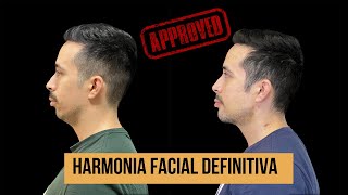 HARMONIA DEFINITIVA DO PERFIL FACIAL [upl. by Aniela]