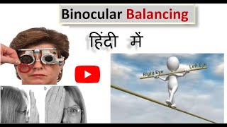 Binocular balancing Made easy in Hindi [upl. by Rush658]