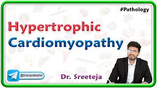 9 Hypertrophic Cardiomyopathy Pathology USMLE Step 1 [upl. by Eiramnwad]