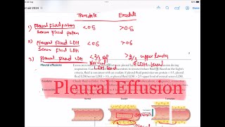 Pleural Effusion  Transudate Vs Exudate Respiratory 47  First Aid USMLE Step 1 in UrduHindi [upl. by Elbert]