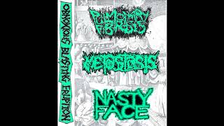 Pulmonary Fibrosis  Metastasis  Nasty Face  Obnoxious Blasting Eruption 3 way split [upl. by Ahidam294]