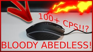 So I Got The New Bloody ABedless [upl. by Eitsym]