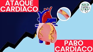 ATAQUE Cardíaco VS PARO Cardíaco [upl. by Britte347]