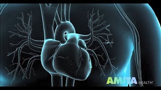 Coronary Angiography amp Cardiac Catheterization — AMITA Health [upl. by Kenweigh]