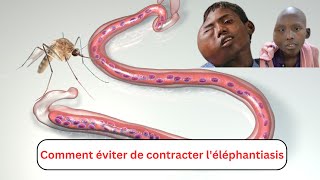 Comment éviter de contracter léléphantiasis [upl. by Kumler]