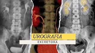 UROGRAFIA EXCRETORA  ESTUDIO RADIOLÓGICO radiologia radiology medico [upl. by Chrysa]