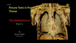 Picture Tests in Anatomy  Thorax  Mediastinum 1 [upl. by Kriss]