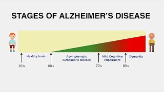 Diagnosing Alzheimer’s Disease [upl. by Atnoid]