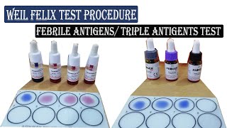 Weil Felix Test ।। Febrile Antigens Triple Antigens Test Procedure Full Details [upl. by Dang902]