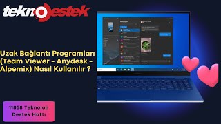 Uzak Bağlantı Programları Team Viewer  Anydesk  Alpemix Nasıl Kullanılır [upl. by Wobniar]