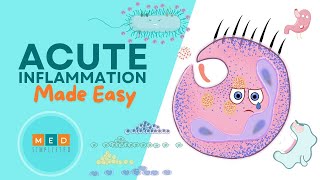 Acute Inflammation Made Easy [upl. by Mella]