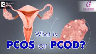 What is PCOS or PCOD  Dr Bandita Sinha of Cloudnine Hospitals  Doctors Circle [upl. by Warrenne]