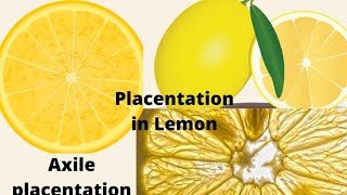 Transverse section of lemon fruit showing the seed and Axile placentation [upl. by Gyatt]